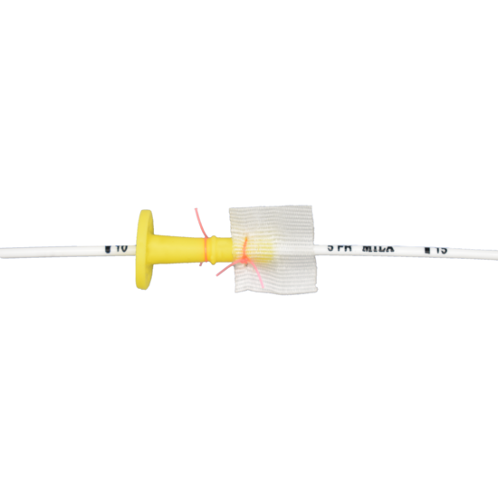 MILA Tomcat -katetri, 1,17 x 250 mm:iin asti säädettävä